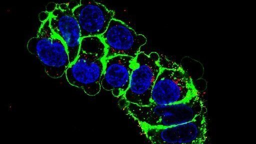 Bild von Immunfluoreszenzmikroskop